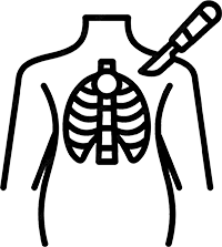 Ícone Cirurgia Torácica